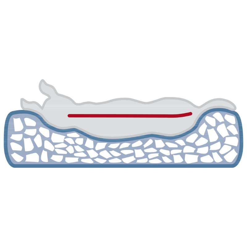 CAMA ORTOPEDICA PERROS VITAL TRIXIE 100x80 CM