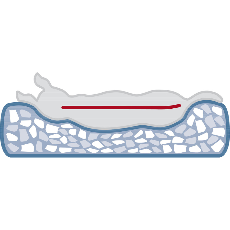 CAMA ORTOPEDICA PERRO VITAL CALITO TRIXIE 80 X 60 CM